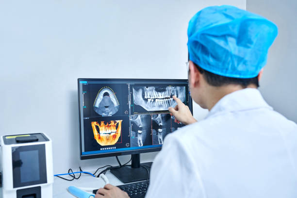 Best Emergency Root Canal Treatment in Sparta, MO