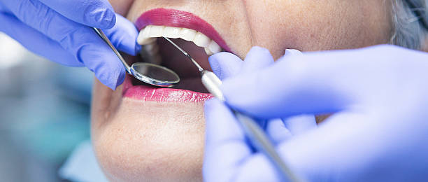 Best Emergency Root Canal Treatment in Sparta, MO